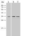 EB1 Antibody in Western Blot (WB)
