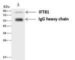 IFT81 Antibody in Immunoprecipitation (IP)