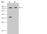 IFT81 Antibody in Western Blot (WB)