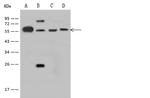 DDX19A Antibody in Western Blot (WB)