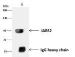 DDX21 Antibody in Immunoprecipitation (IP)