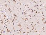 SSR3 Antibody in Immunohistochemistry (Paraffin) (IHC (P))