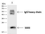 SSR3 Antibody in Immunoprecipitation (IP)