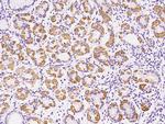MTCO2 Antibody in Immunohistochemistry (Paraffin) (IHC (P))