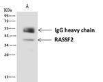 RASSF2 Antibody in Immunoprecipitation (IP)