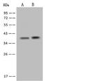 RASSF2 Antibody in Western Blot (WB)