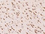 RPS18 Antibody in Immunohistochemistry (Paraffin) (IHC (P))