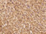 RPS18 Antibody in Immunohistochemistry (Paraffin) (IHC (P))