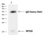 RPS18 Antibody in Immunoprecipitation (IP)