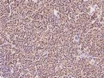 RPL9 Antibody in Immunohistochemistry (Paraffin) (IHC (P))