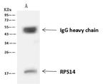 RPS14 Antibody in Immunoprecipitation (IP)