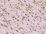 RPS17 Antibody in Immunohistochemistry (Paraffin) (IHC (P))