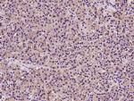 RPS17 Antibody in Immunohistochemistry (Paraffin) (IHC (P))