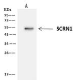 SCRN1 Antibody in Immunoprecipitation (IP)