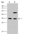 RFXANK Polyclonal Antibody