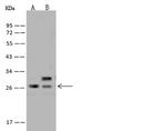 SPC24 Polyclonal Antibody