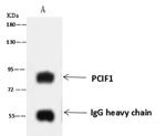 PCIF1 Antibody in Immunoprecipitation (IP)
