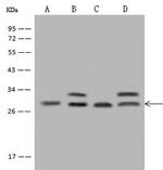 PDCD10 Polyclonal Antibody