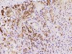 PEG10 Antibody in Immunohistochemistry (Paraffin) (IHC (P))