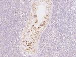 PDXDC1 Antibody in Immunohistochemistry (Paraffin) (IHC (P))