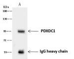 PDXDC1 Antibody in Immunoprecipitation (IP)