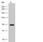 PDXDC1 Antibody in Western Blot (WB)