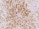 PGAM1 Antibody in Immunohistochemistry (Paraffin) (IHC (P))