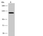 PITRM1 Polyclonal Antibody