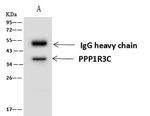 PPP1R3C Antibody in Immunoprecipitation (IP)