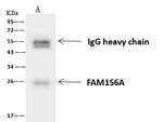 FA156 Antibody in Immunoprecipitation (IP)