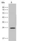 FA156 Polyclonal Antibody