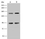 ADNP Antibody in Western Blot (WB)