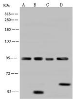 AFG3L2 Antibody in Western Blot (WB)