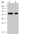 HSDL2 Antibody in Western Blot (WB)
