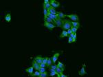 FARSA Polyclonal Antibody