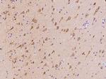 MAP1 Polyclonal Antibody
