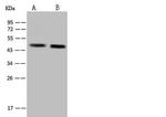 MAP1 Antibody in Western Blot (WB)