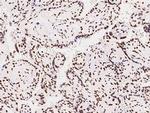 RBM14 Antibody in Immunohistochemistry (Paraffin) (IHC (P))