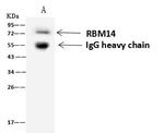 RBM14 Antibody in Immunoprecipitation (IP)