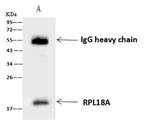 RPL18A Antibody in Immunoprecipitation (IP)