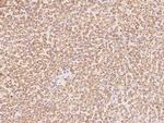 ZNF313 Antibody in Immunohistochemistry (Paraffin) (IHC (P))