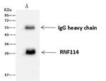 ZNF313 Antibody in Immunoprecipitation (IP)