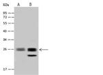 ZNF313 Antibody in Western Blot (WB)