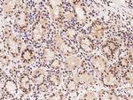 RFC3 Antibody in Immunohistochemistry (Paraffin) (IHC (P))