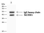 RFC3 Antibody in Immunoprecipitation (IP)