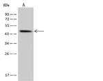 SLC35E1 Polyclonal Antibody