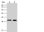 EXOSC4 Polyclonal Antibody