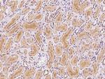 GLRB Polyclonal Antibody