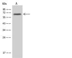 ZNF250 Polyclonal Antibody