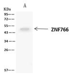 ZNF766 Antibody in Immunoprecipitation (IP)
